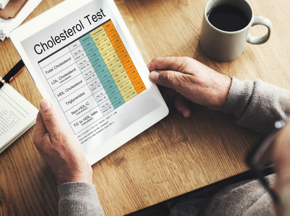 Kaip natūraliai pagerinti cholesterolio rodiklius?